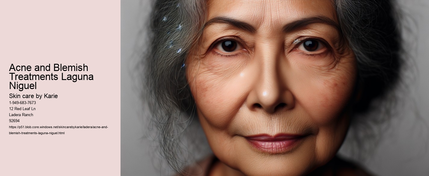 Acne and Blemish Treatments Laguna Niguel