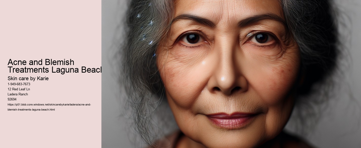 Acne and Blemish Treatments Laguna Beach